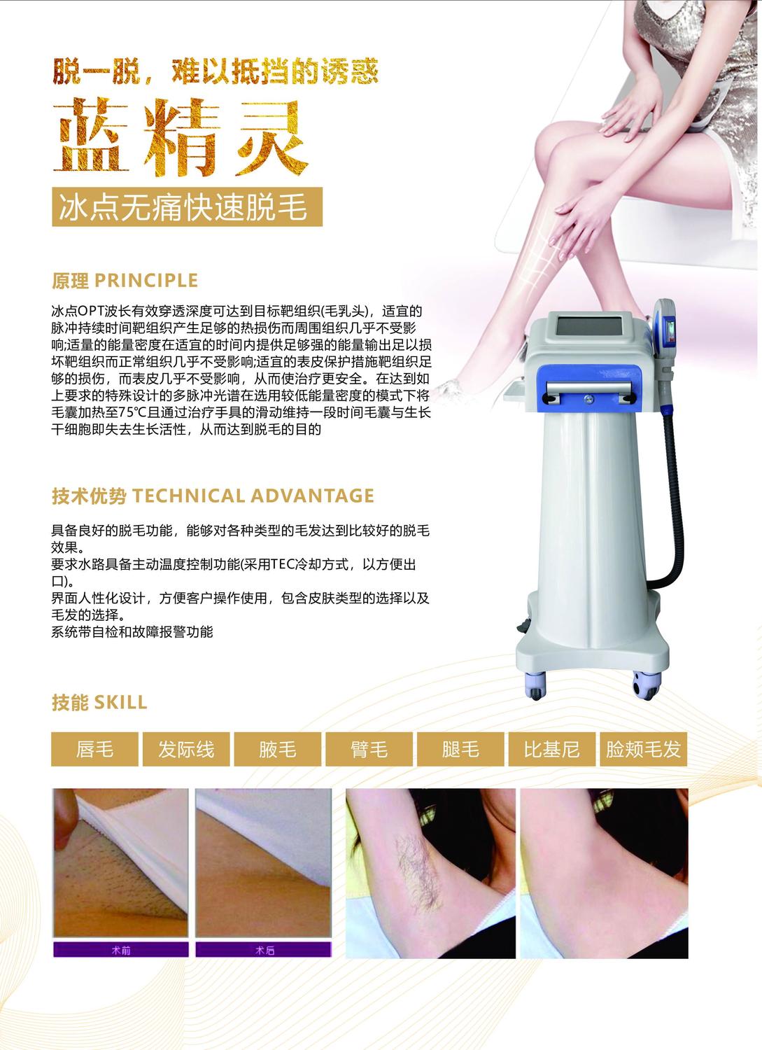 opt冰点快速脱毛